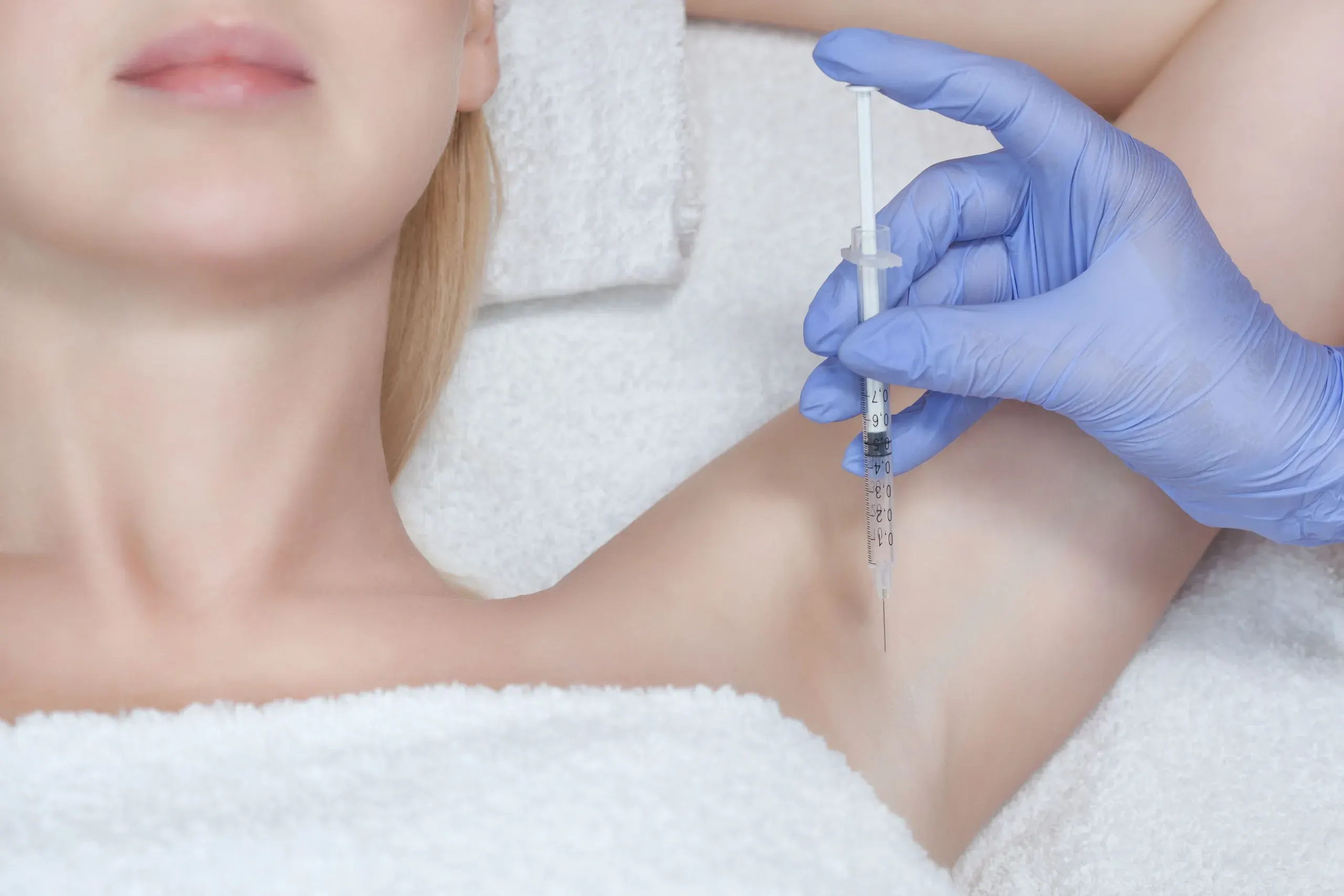 Botox treatment for hyperhidrosis and excessive sweating