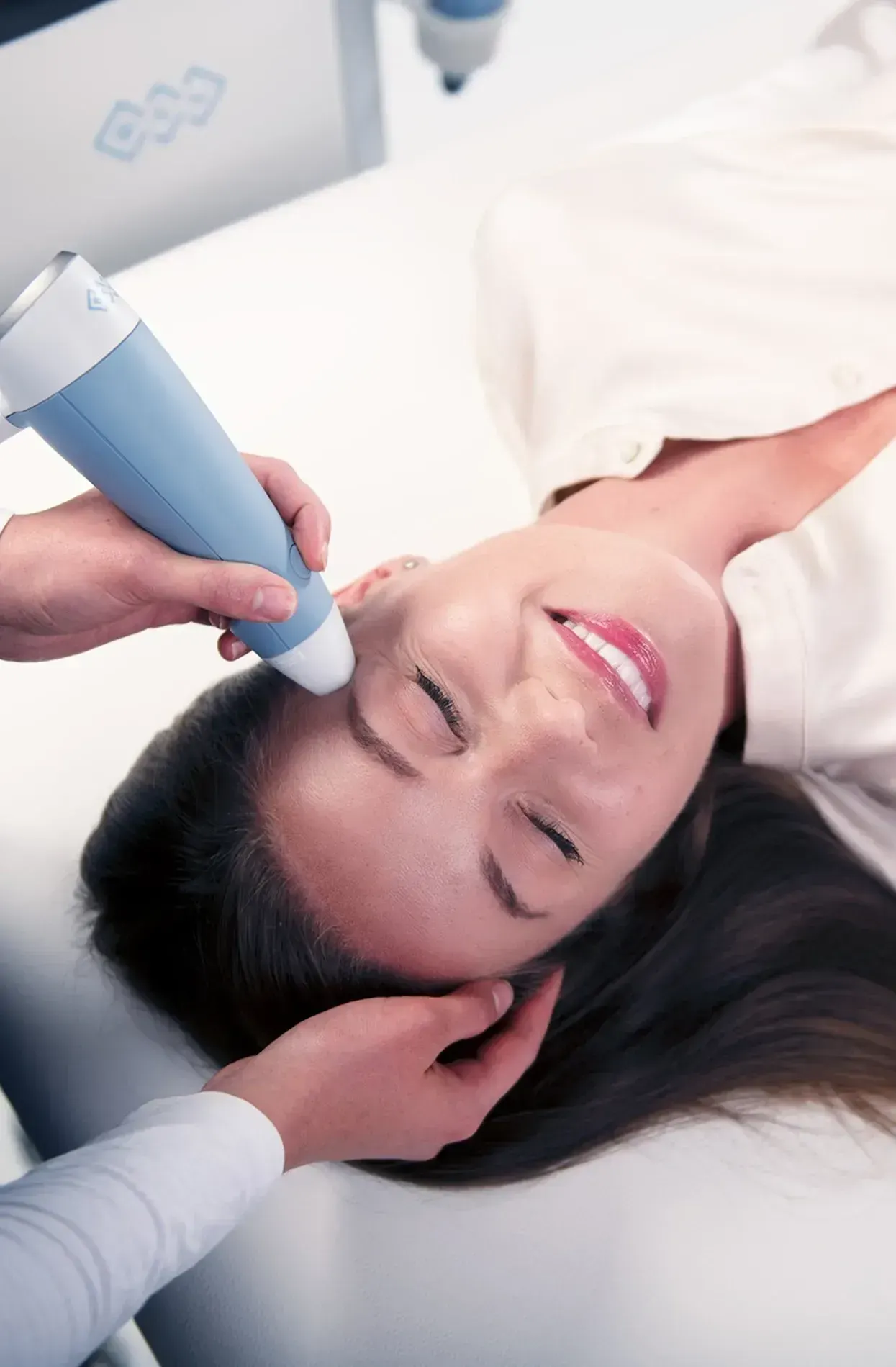 What Is Exion RF Microneedling?